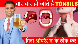 बिना Operation के Tonsils घर में ठीक करें  Tonsillitis Home Remedies [upl. by Lillywhite]