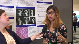 Dr Sheetal Patel at RWCS 2018 Poster Presentation [upl. by Eceinej]