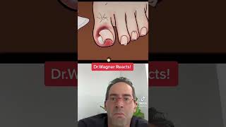 ASMR INGROWN TOENAIL REMOVAL 😜 shorts asmr ingrowntoenail [upl. by Derna]