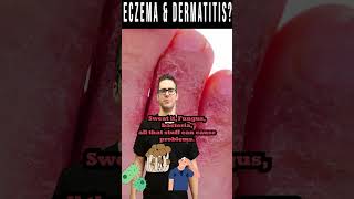 Dermatitis amp Eczema Dry Itchy Skin or Rash not Better [upl. by Hacceber]