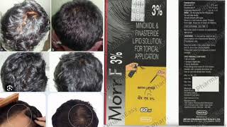 Morr F 3 Solution MINOXIDIL amp FINASTERIDE LIPID SOLUTION FOR TOPICAL APPLICATION [upl. by Defant563]