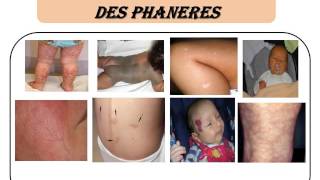 PEDIATRIE Examen clinique du nourrisson [upl. by Enyallij]