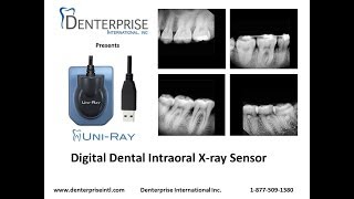 UniRay Digital Dental Xray Sensor Intro [upl. by Nuahsel]