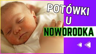 Potówki u noworodka [upl. by Freddi]