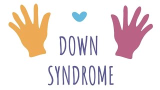 Downs syndrome therapeutic interventions [upl. by Amaso]