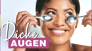 7 SOSTipps gegen geschwollene Augen die sofort helfen [upl. by Anilegnave]