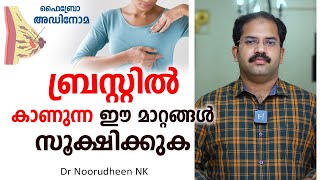 ബ്രസ്റ്റിൽ കാണുന്ന ഈ മാറ്റങ്ങൾ സൂക്ഷിക്കുക  Fibroadenoma  Dr Noorudheen NK [upl. by Merle]