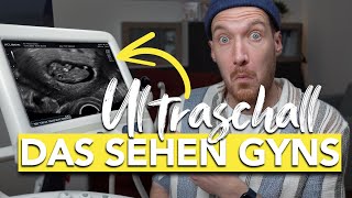 Was ist das Ultraschall in der Schwangerschaft enträtselt I vom Embryo bis zum Baby [upl. by Lello]