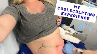 MY COOLSCULPTING EXPERIENCE and GIVEAWAY  Before amp Afters  KelseyRae Mua [upl. by Hortense612]