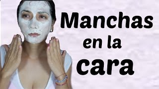 REMEDIO PARA MANCHAS EN LA CARA FACIL [upl. by Rianna475]