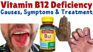 Vitamin B12 Deficiency – Symptoms Causes Diagnosis Treatment amp Prevention  Cobalamin Deficiency [upl. by Alwyn]