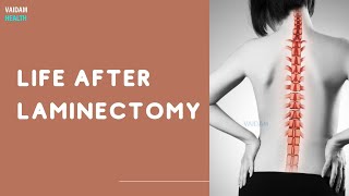 Life After Laminectomy [upl. by Ellerahs4]