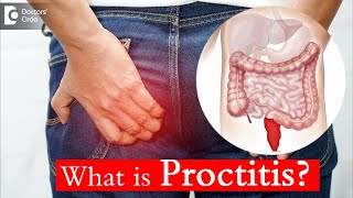 Proctitis Causes Treatment and Surgery  Dr Rajasekhar M R  Doctors Circle [upl. by Ahsinyt]