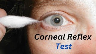 what is the corneal reflex  Corneal Sensation  blink reflex  Assessment of corneal reflex test [upl. by Arahsak]