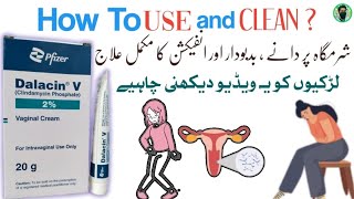 Dalacin v vaginal cream  how to use Clindamycin Phosphate vaginal cream [upl. by Annaik]