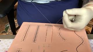 Subcutaneous running with deep buried knot 3mm incision [upl. by Otilopih]