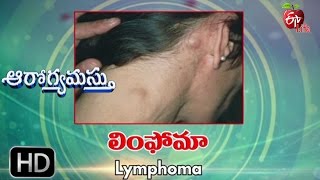 Aarogyamastu  Lymphoma  18th May 2017  ఆరోగ్యమస్తు [upl. by Drolet]