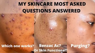 What Really Helped My Acne Pimples Acne SpotsDark Marks [upl. by Irrac]