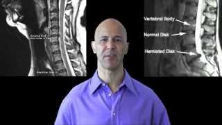 Drinking Water Reduces Neck Pain Back Pain amp Arthritis  Dr Mandell [upl. by Sedgewinn]