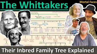 THE WHITTAKERS A West Virginia Inbred Family Tree Explained Mortal Faces [upl. by Ramel]