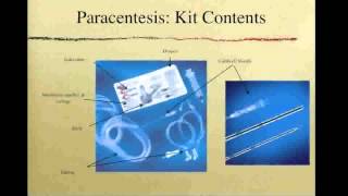 OSCE Paracentesis [upl. by Quintus301]