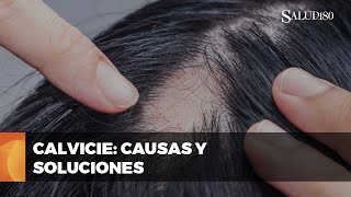 ✅ Entendiendo la calvicie causas y tratamientos  Salud180 🌿 [upl. by Vedis]