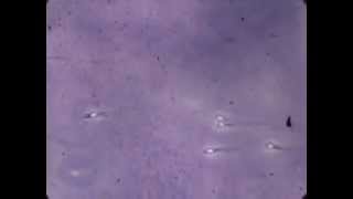 Fascinating lab footage of sperm [upl. by Radnaxela]