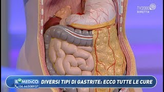 Il mio medico  Diversi tipi di gastrite ecco tutte le cure [upl. by Rohclem]