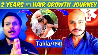 My 2 years hair regrowth journey  Story  Hair Fall  hair loss  hair regrowth  multivitamin [upl. by Electra]