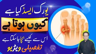 URIC ACID  Kya hai Kyun Hota Hai  Best Remedy  Details Video about URIC ACID  ILAJ Kaysa Karain [upl. by Avitzur]