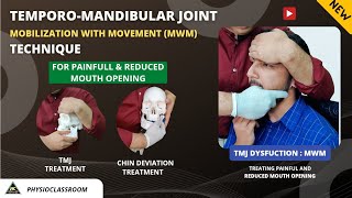 TMJ MOBILIZATION WITH MOVEMENT TECHNIQUE FOR TREATING PAINFUL AND REDUCED MOUTH OPENING [upl. by Hickey]