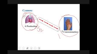 Cardiopathie congénitale [upl. by Borman905]