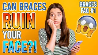 Can Braces With Extractions Ruin Your Face  Braces FAQ Pt 1 [upl. by Nohcim]