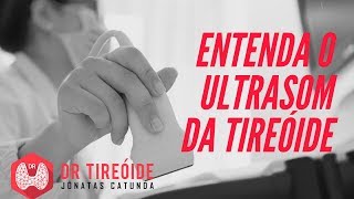 Câncer de tireoide tratamentos inovadores para a cura [upl. by Donaghue]