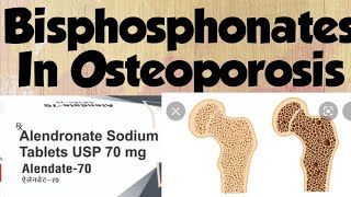 Bisphosphonates Alendronate Zoledronate in Osteoporosis [upl. by Fraya357]