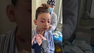 EXTREME Facelift Result  Doctor Reacts [upl. by Drofxer]