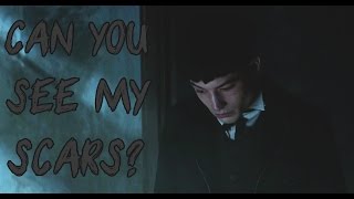 Credence Barebone Graves  Can you see my scars Fantastic Beasts and WTFT [upl. by Mw]