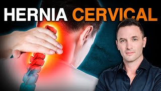 ¿Dolor de Cuello o Cabeza Posible Hernia Cervical  Soluciones Efectivas ✅ [upl. by Adnohryt]