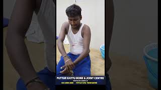 elbow dislocation treatment  முழங்கை மூட்டு விலகல்  vadapalani  puttur kattu [upl. by Mik]