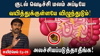 யாருக்கெல்லாம் appendix பிரச்சனை வரும்  Appendicitis explained in Tamil  Uyirmei EP  09 [upl. by Yendahc]