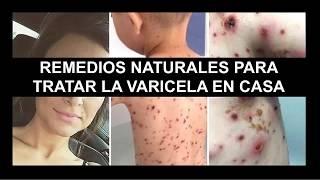 Conoce estos INCREÍBLES remedios NATURALES para tratar la VARICELA en casa [upl. by Hanleigh]