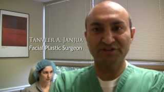 FACIAL LIPOSUCTION  DR TANVEER JANJUA  NEW JERSEY [upl. by Aicilana404]