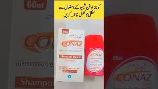 Conaz Shampoo for Dandruff and Hair Fall  AK Beauty Reviews [upl. by Tivad608]