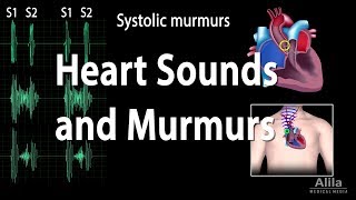 Heart Sounds and Heart Murmurs Animation [upl. by Ispep401]