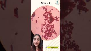 Welcome to today’s Micro Mystery  Can you crack this case  Day 9  Dr Devyani Puri [upl. by Salvidor415]