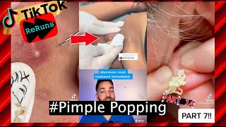 Over 20 Minutes Of Pimple Popping Black Heads Extractions TikTok Compilation  Part 14 [upl. by Celine853]