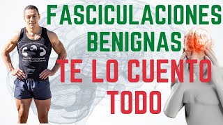 Fasciculaciones Benignas te lo cuento TODO [upl. by Hidie]