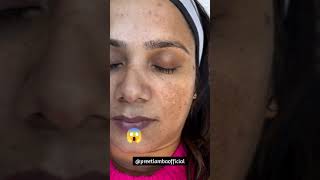 Advanced Herbal Skin Treatment  Preet Kaur Lamba [upl. by Zobias]