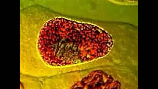 les étapes de la mitose observation réelle par microscope 🔬 [upl. by Eneryc]