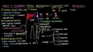 What is chronic myelogenous leukemia [upl. by Rola]